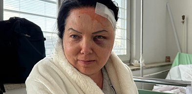 Longina Lewicka walczy z glejakiem. Rodzina prosi o wsparcie