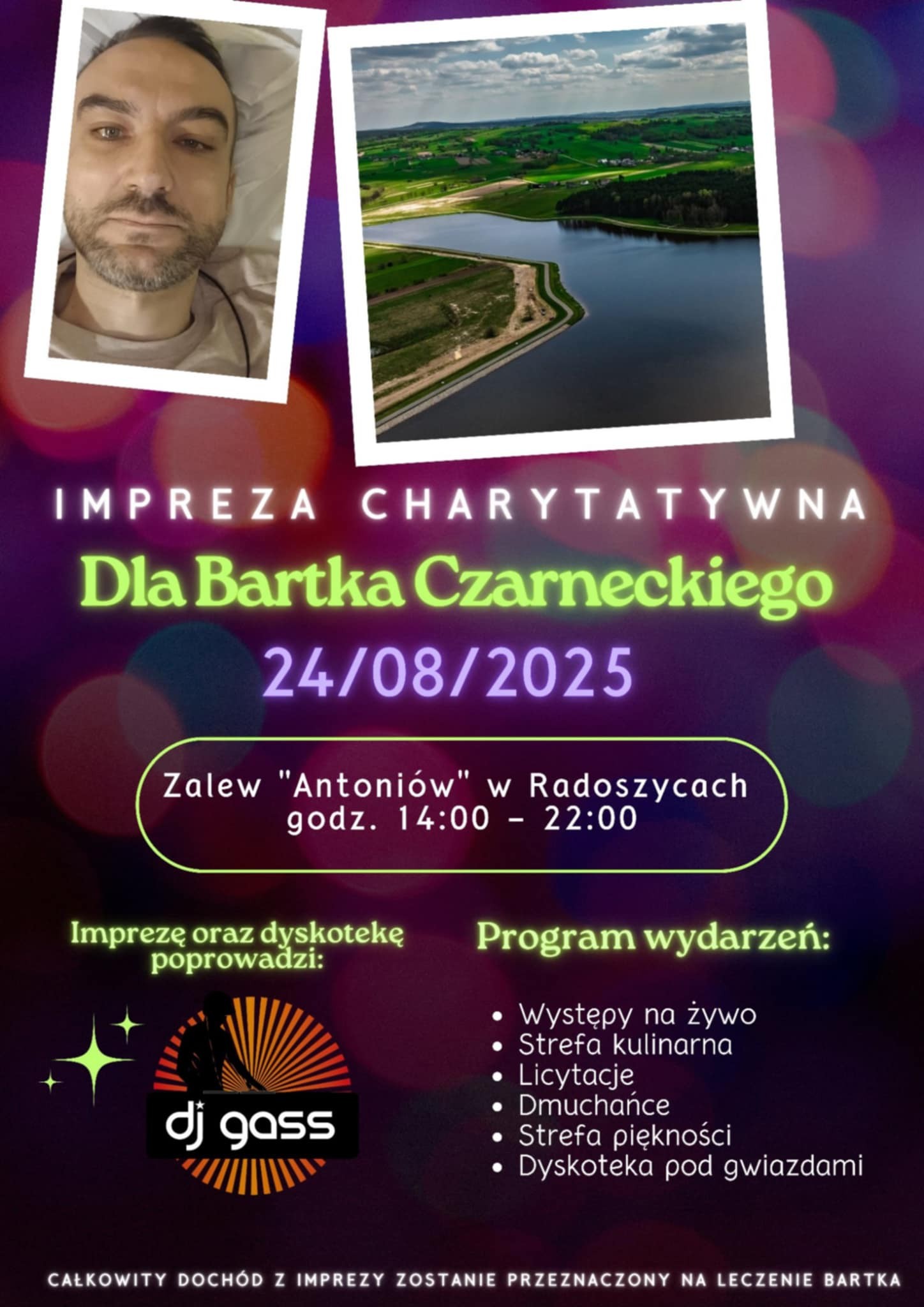 Razem dla Bartka. Nad Antoniowem odbędzie się festyn charytatywny